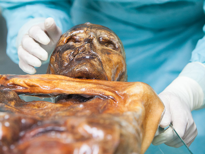 Lifestyle is a threat to gut bacteria: Ötzi proves it